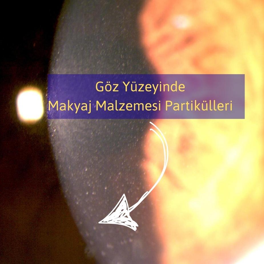 Gözlerden Seçmeler